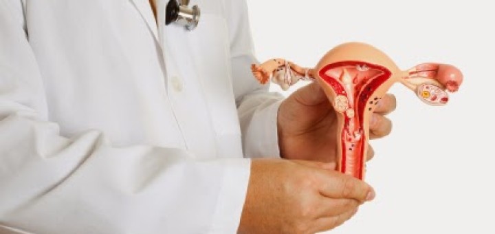 Endometrioza